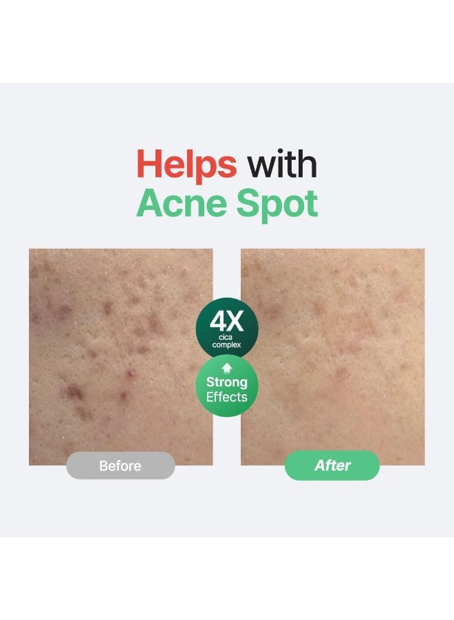 PURITO Centella Unscented Serum, Korean Centella, for All Skin Types, Ampoule, Soothing, Calming, Facial Serum for face, Vegan & Cruelty-Free, Korean Skin Care, 60ml 2fl.oz - Image 2